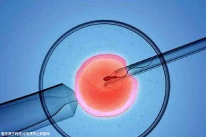 包生男孩助孕机构代生供卵医院